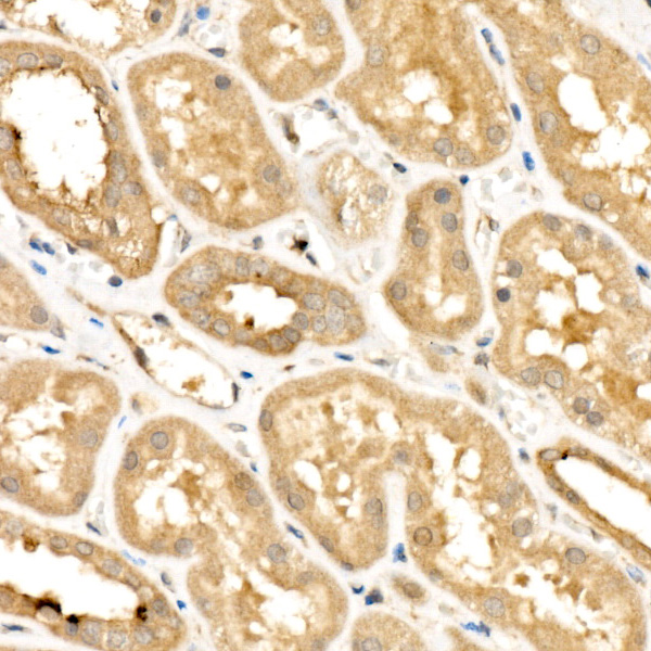 RELB Rabbit monoclonal antibody