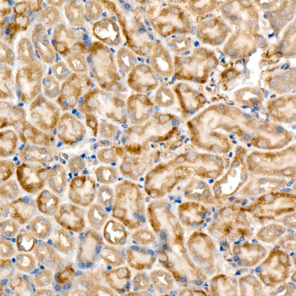 RELB Rabbit monoclonal antibody