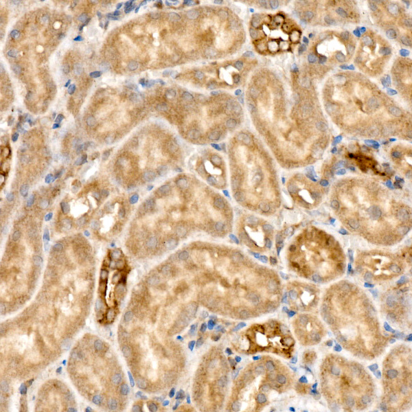 RELB Rabbit monoclonal antibody