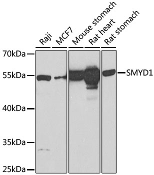 SMYD1 Rabbit polyclonal antibody