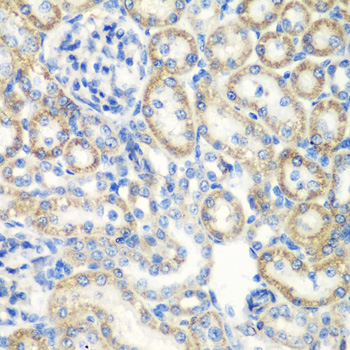 SMYD1 Rabbit polyclonal antibody