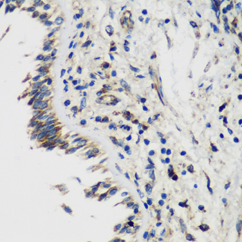 SMYD1 Rabbit polyclonal antibody