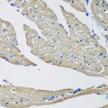 SMYD1 Rabbit polyclonal antibody