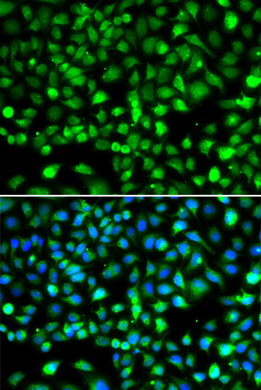 SMYD1 Rabbit polyclonal antibody
