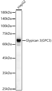 Glypican 3 (GPC3) Rabbit monoclonal antibody