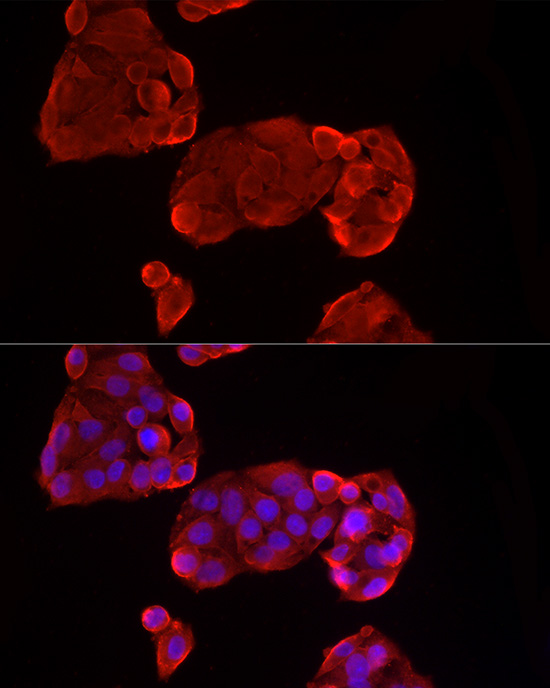 Glypican 3 (GPC3) Rabbit monoclonal antibody