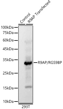 R9AP/RGS9BP Rabbit monoclonal antibody