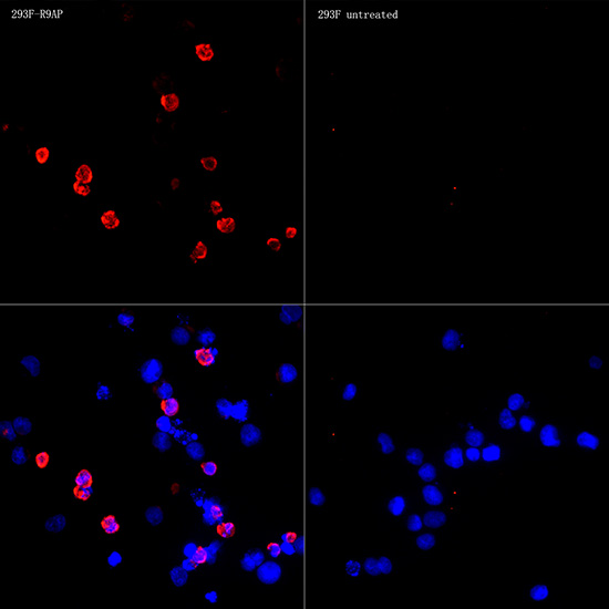 R9AP/RGS9BP Rabbit monoclonal antibody
