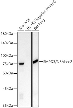 SMPD3/NSMase2 Rabbit monoclonal antibody