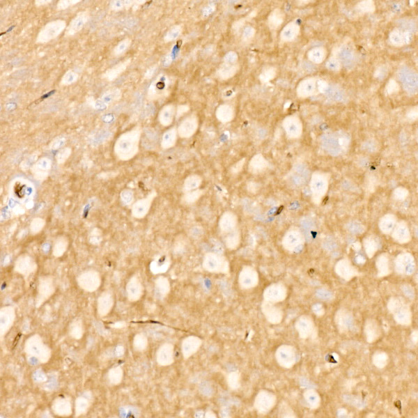SMPD3/NSMase2 Rabbit monoclonal antibody
