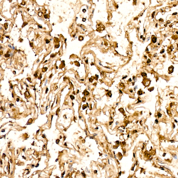 AGER Rabbit monoclonal antibody