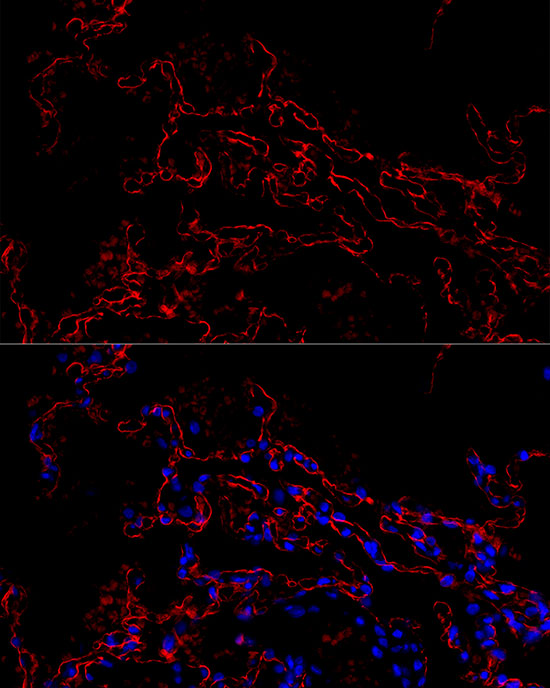 AGER Rabbit monoclonal antibody
