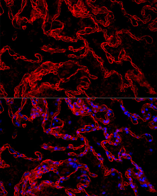 AGER Rabbit monoclonal antibody
