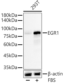 EGR1 Rabbit monoclonal antibody