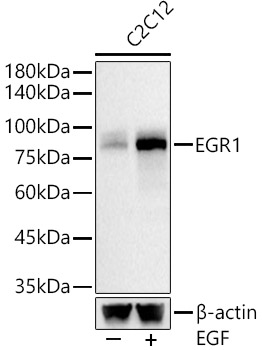 EGR1 Rabbit monoclonal antibody
