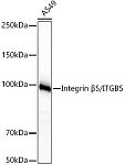 Western blot - Integrin β5/ITGB5 Rabbit mAb (A23428)