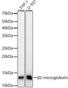 Western blot analysis of various lysates, using [KD Validated] beta 2 Microglobulin Rabbit mAb (A23430) at 1:1000 dilution.<br/>Secondary antibody: HRP-conjugated Goat anti-Rabbit IgG (H+L) (AS014) at 1:10000 dilution.<br/>Lysates/proteins: 25μg per lane.<br/>Blocking buffer: 3% nonfat dry milk in TBST.<br/>Detection: ECL Basic Kit (RM00020).<br/>Exposure time: 30s.