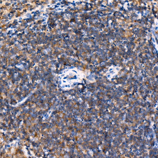 USP25 Rabbit monoclonal antibody