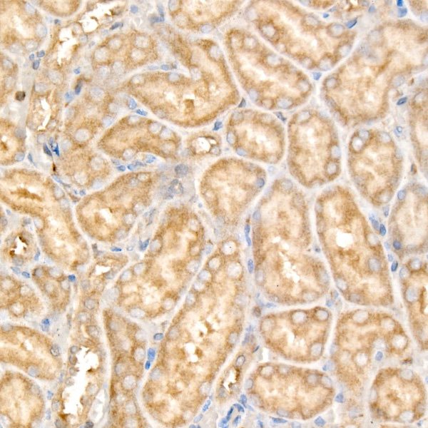 USP25 Rabbit monoclonal antibody