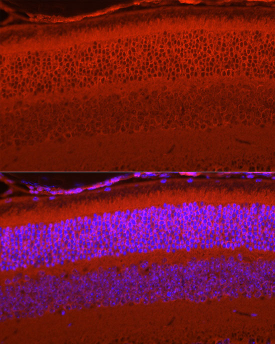 RPGR Rabbit monoclonal antibody