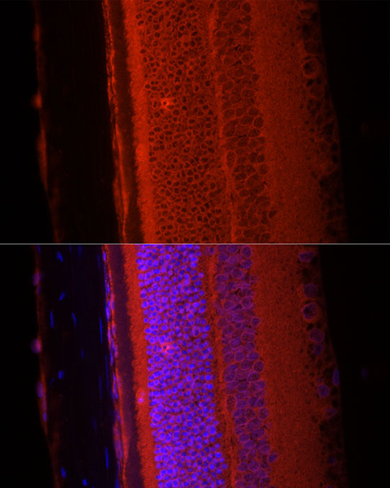 RPGR Rabbit monoclonal antibody