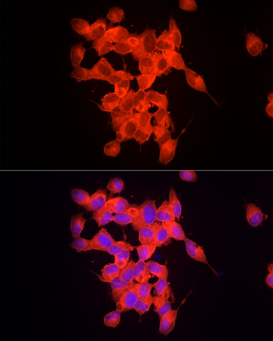 RPGR Rabbit monoclonal antibody