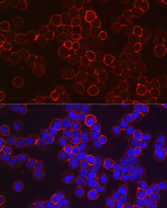 HBG1/HBG2 Rabbit polyclonal antibody