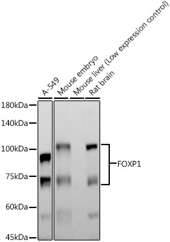 FOXP1 Rabbit monoclonal antibody