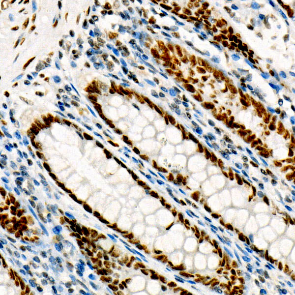 FOXP1 Rabbit monoclonal antibody