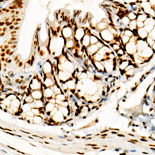 FOXP1 Rabbit monoclonal antibody