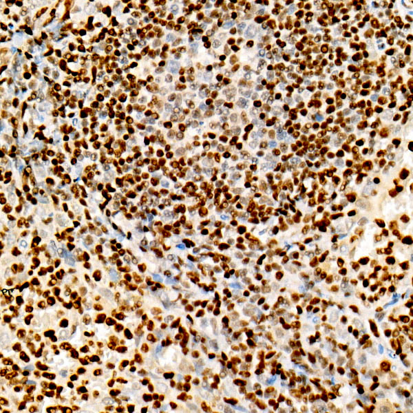 FOXP1 Rabbit monoclonal antibody