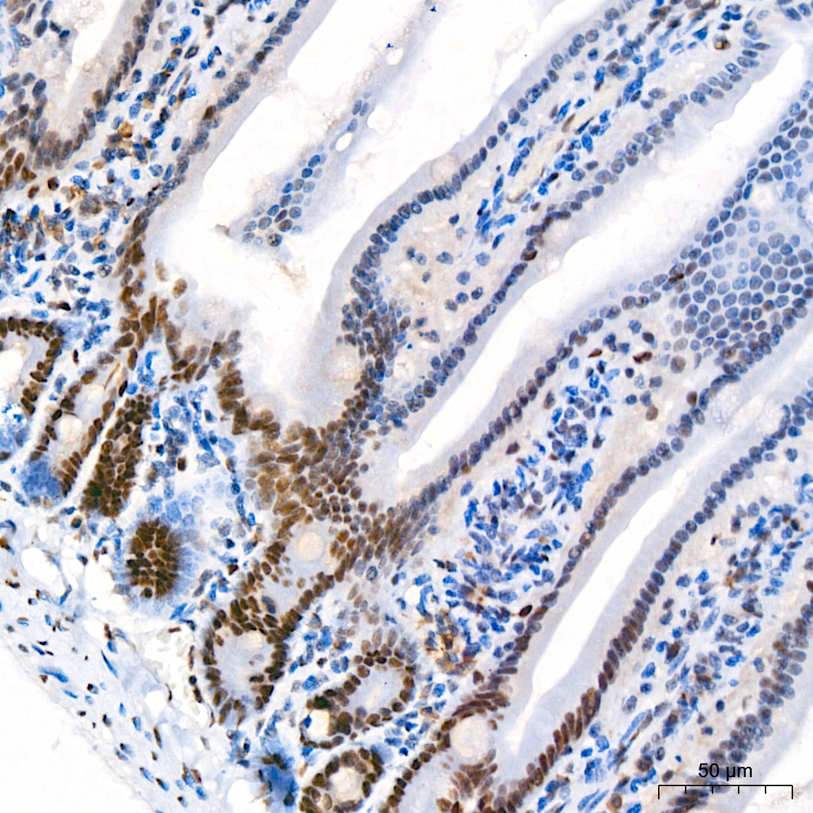FOXP1 Rabbit monoclonal antibody