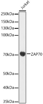 ZAP70 Rabbit monoclonal antibody