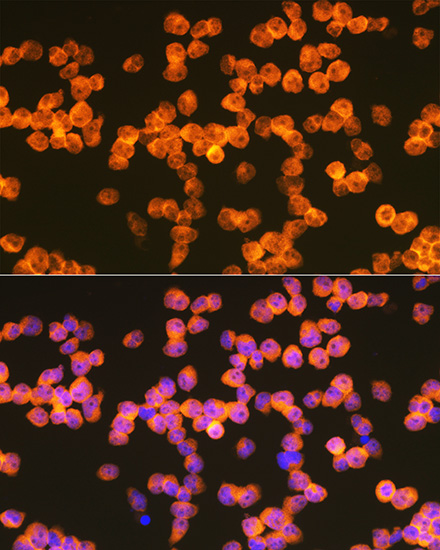 ZAP70 Rabbit monoclonal antibody