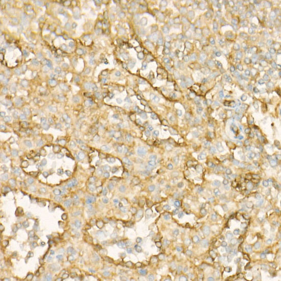BST2 Rabbit monoclonal antibody
