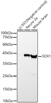 SOX1 Rabbit monoclonal antibody
