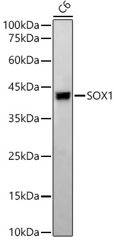 SOX1 Rabbit monoclonal antibody