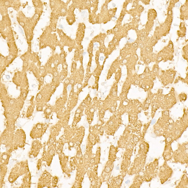 BHMT Rabbit monoclonal antibody