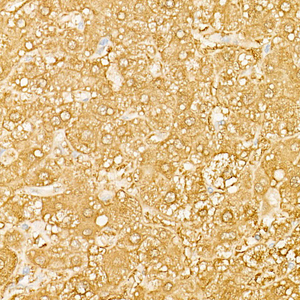 BHMT Rabbit monoclonal antibody