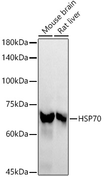 HSP70 Rabbit monoclonal antibody