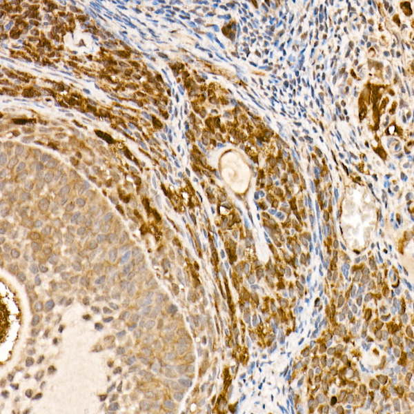 HSP70 Rabbit monoclonal antibody
