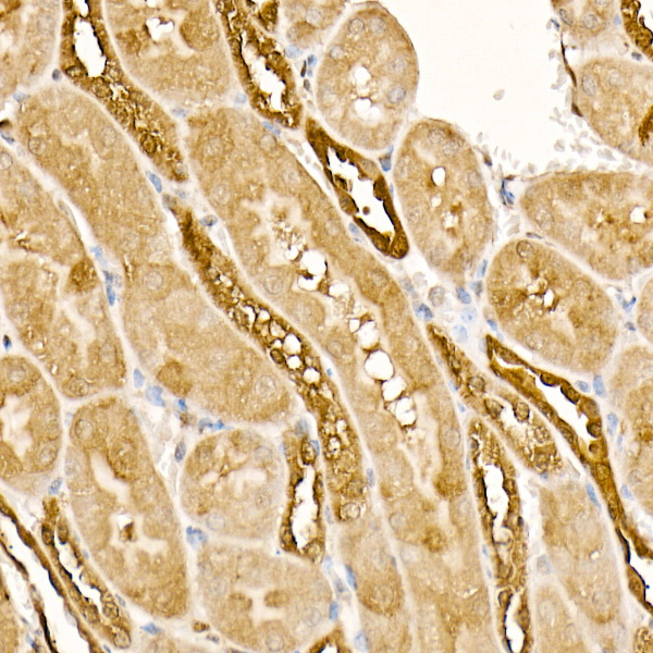 HSP70 Rabbit monoclonal antibody
