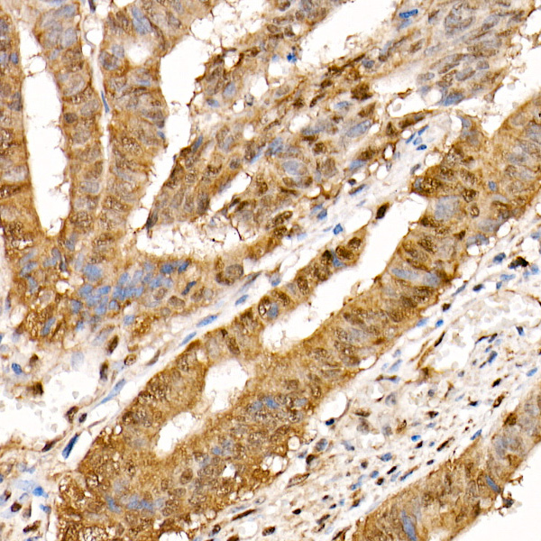 HSP70 Rabbit monoclonal antibody