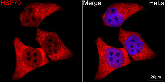 HSP70 Rabbit monoclonal antibody