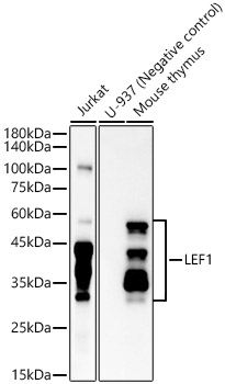 LEF1 Rabbit monoclonal antibody