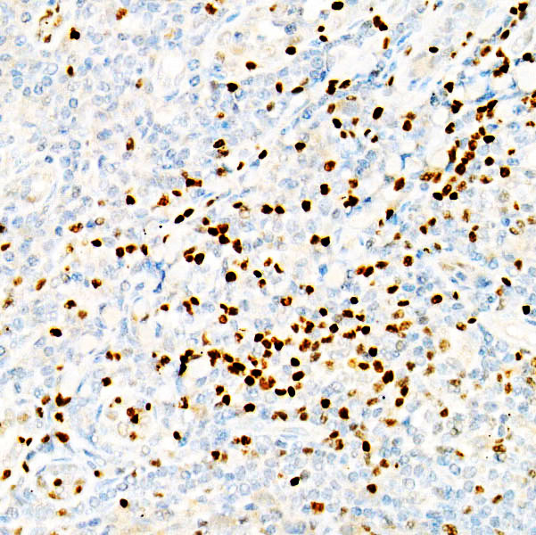 LEF1 Rabbit monoclonal antibody