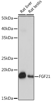 FGF21 Rabbit monoclonal antibody