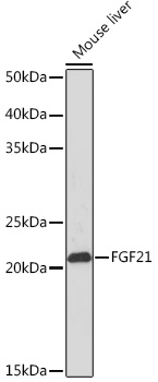 FGF21 Rabbit monoclonal antibody