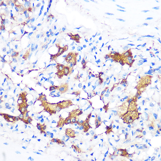 FGF21 Rabbit monoclonal antibody