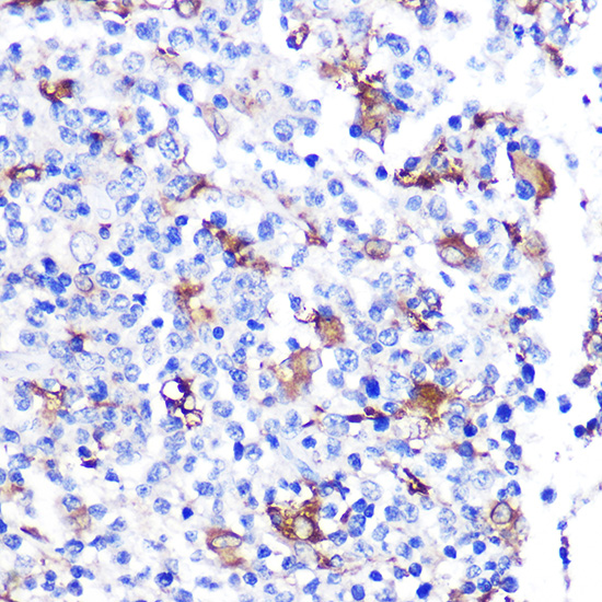 FGF21 Rabbit monoclonal antibody